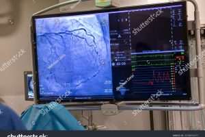 stock-photo-istanbul-turkey-september-heart-operating-room-complex-heart-surgery-cardiovascular-2238054377.jpg
